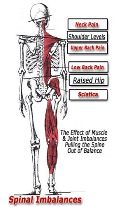 spinal imbalances