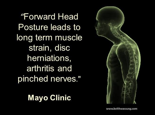 yoga for better posture